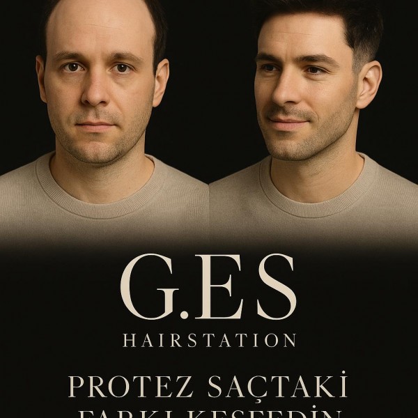Güneyes Hair Station’da Protez Saç Bakımına Özel Fırsat – 30 Gün Geçerli!