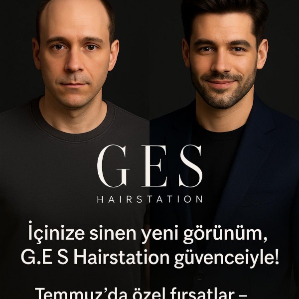 İzmir Gaziemir’de A Kalite Protez Saç Fırsatı – Güney ES ile Doğallığı Yaşa!