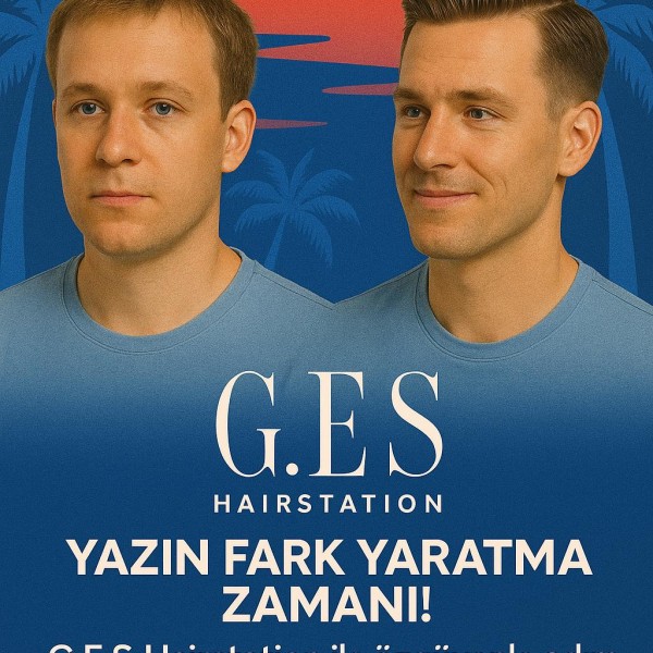 İzmir Gaziemir’de A Kalite Protez Saç Fırsatı – Güney ES ile Doğallığı Yaşa! 5